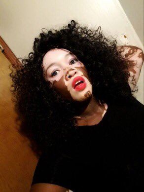 Iomikoe Johnson, la modella nera sta diventando bianca