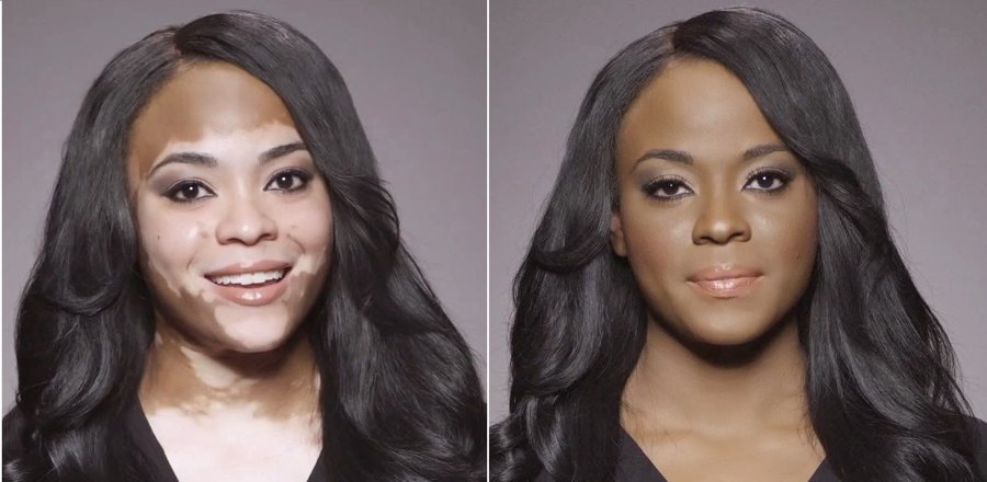 Come coprire le macchie della vitiligine con il make-up