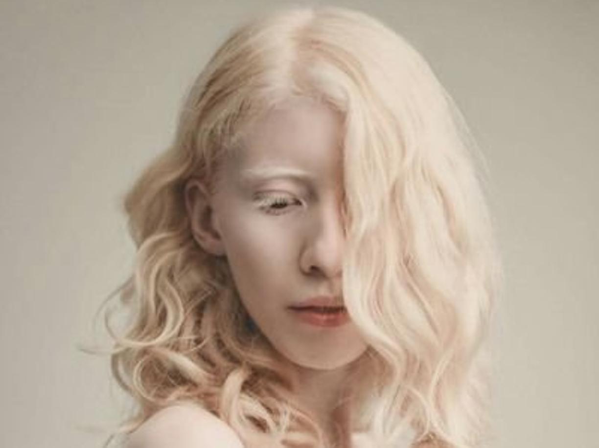 Ruby Vizcarra combatte i pregiudizi: la modella lancia il Movimiento Albino Latino