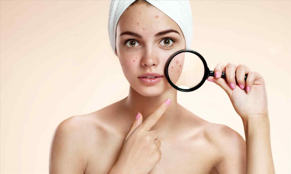 Make-up pelle grassa: fondotinta non comedogeno oil free?