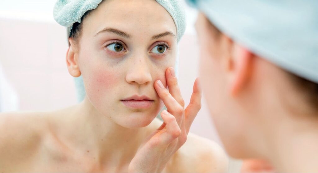 Come nascondere la peluria del viso con il make-up